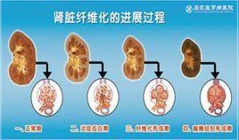 腎臟纖維化