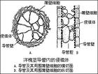 擬侵填體