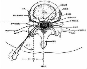 頸肩腰腿疼