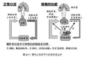 持續性交接區折返性心動過速