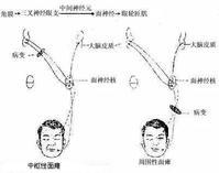 三位一體綜合療法