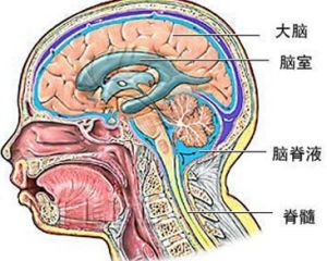 腦缺血性疾病