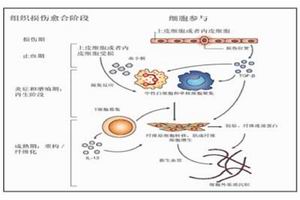 特發性瀰漫性肺纖維化