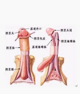 男性假性尖銳濕疣