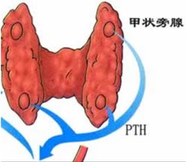 甲狀旁腺激素