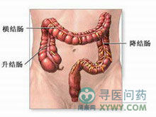 小兒假膜性腸炎