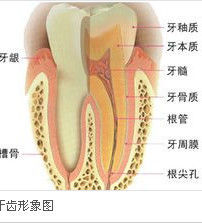 齲牙