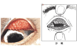 砂眼病原體