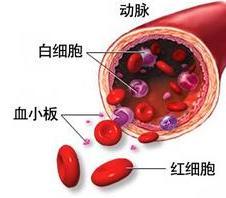 動脈硬化性腦病