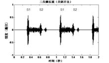 圖7 二尖瓣反流（關閉不全、伴有第三心音）