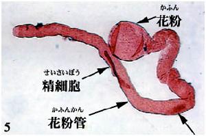 美爾伊避孕針