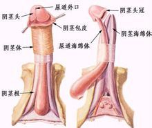 陰莖畸形示意圖