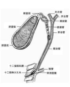 多發性膽囊息肉