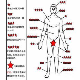 疼痛的級別