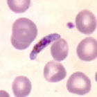 Plasmodium Falciparum的配子體