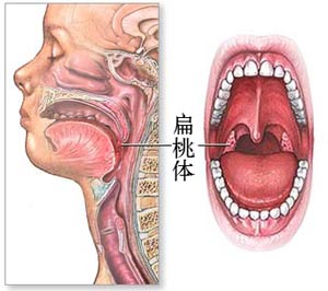 莖突綜合徵