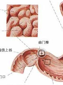 急性胃出血