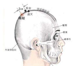 通天[穴位]