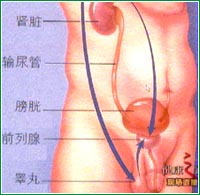 良性前列腺增生