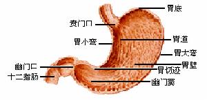 賁門胃底癌