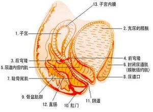 盆腔性不孕症