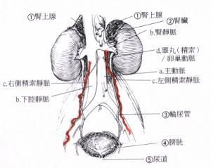 雙側精索靜脈曲張