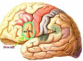 言語功能的部分喪失