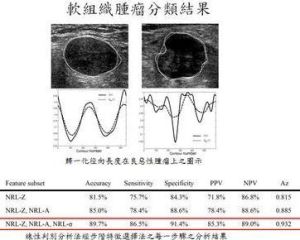 軟組織惡性腫瘤