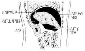 膈下膿腫