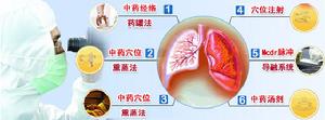 療法解析示意圖