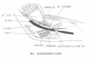 橈管壓迫試驗