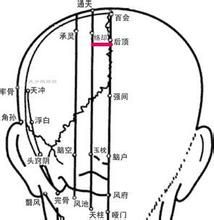 絡卻