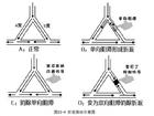 室上性心動過速