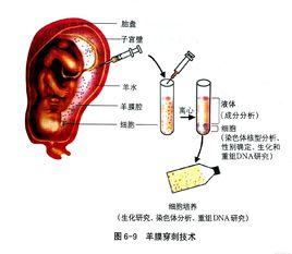 羊膜穿刺