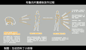 詳解布魯氏桿菌感染髮作