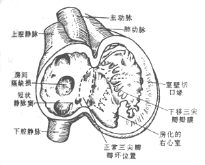 （圖）病理解剖