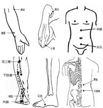 拔罐減肥的具體方法