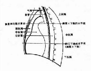 膈膨出