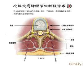 半月神經節阻滯術