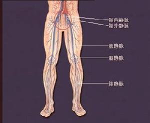 深靜脈血栓形成