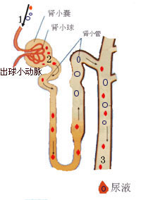 梗阻性尿路疾病