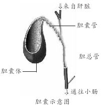 急性化膿性膽管炎