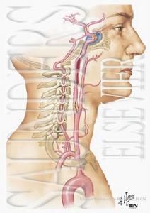 頸內動脈閉塞綜合徵