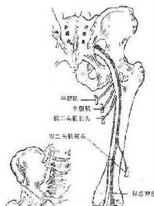 坐骨神經