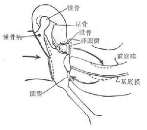 （圖）耳蝸微音器效應