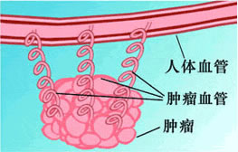 腫瘤血管阻斷療法