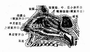 先天性腹膜疝