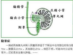 治療措施