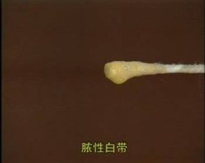 分泌物為黃色