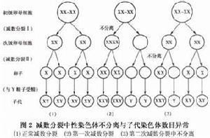 性腺發育不良